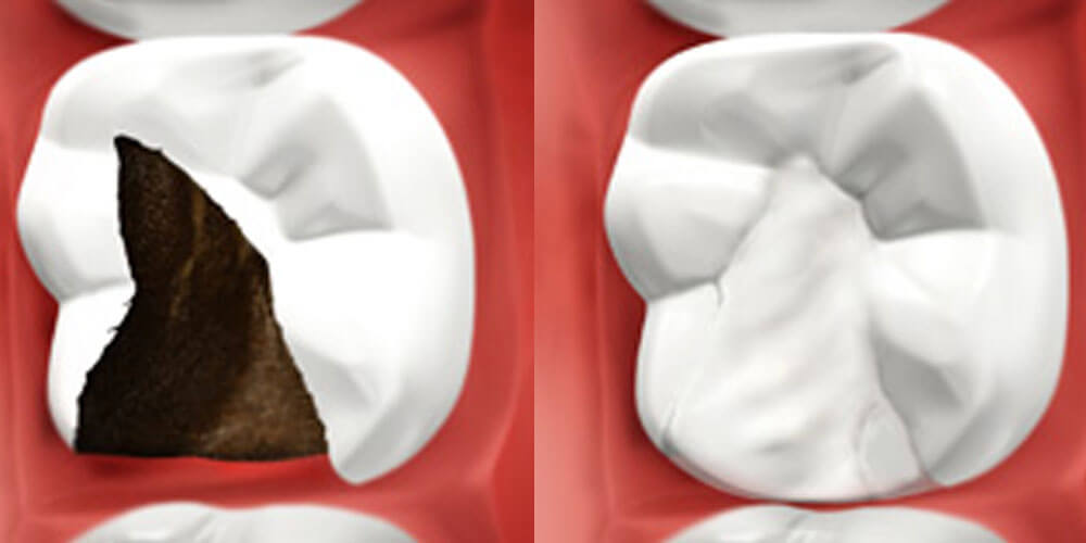 Restorative Dentistry Brampton Earlsbridge Dental